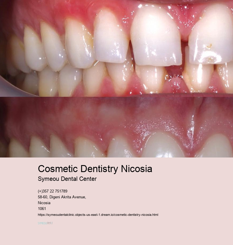 Cosmetic Dentistry Nicosia