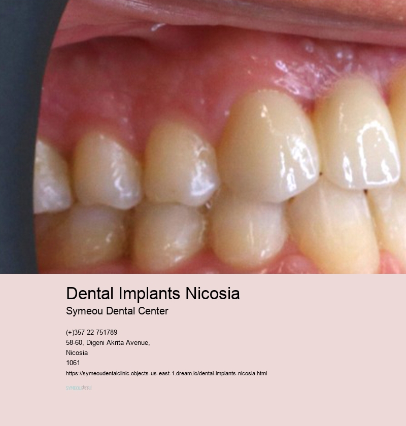 Dental Implants Nicosia